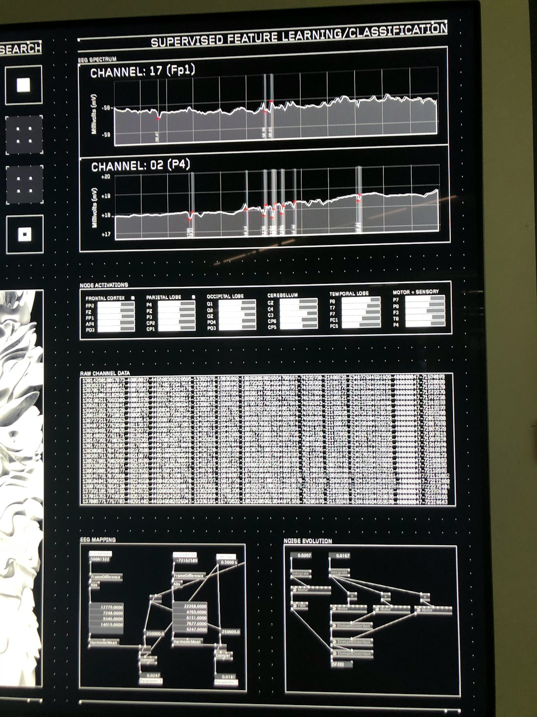 Digital screen displays brain activity data with graphs and charts.